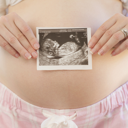 Woman holding scan photo