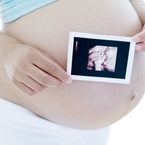 Pregnant woman holding 20 week scan photo
