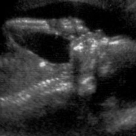I can't believe I have been pregnant for 20 weeks already...
