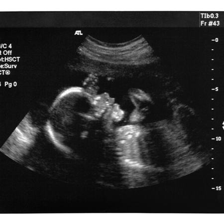 First scan