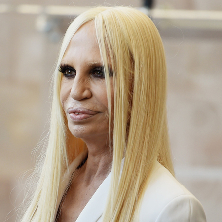 donatella-versace-cosmetic-surgery-after